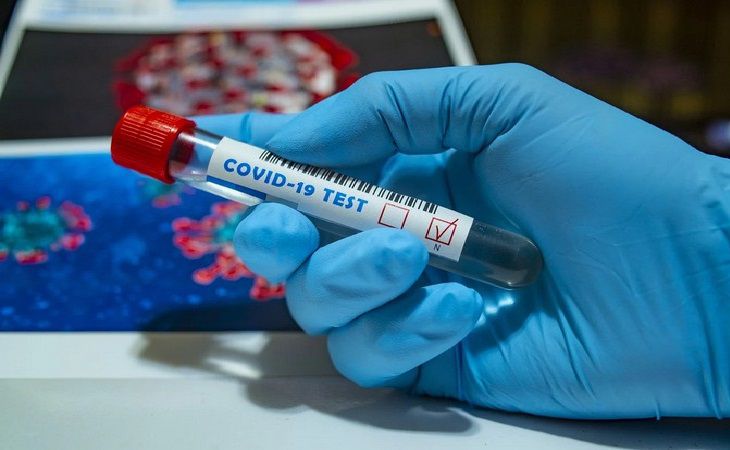 В России ввели ограничения на срок выполнения теста на коронавирус