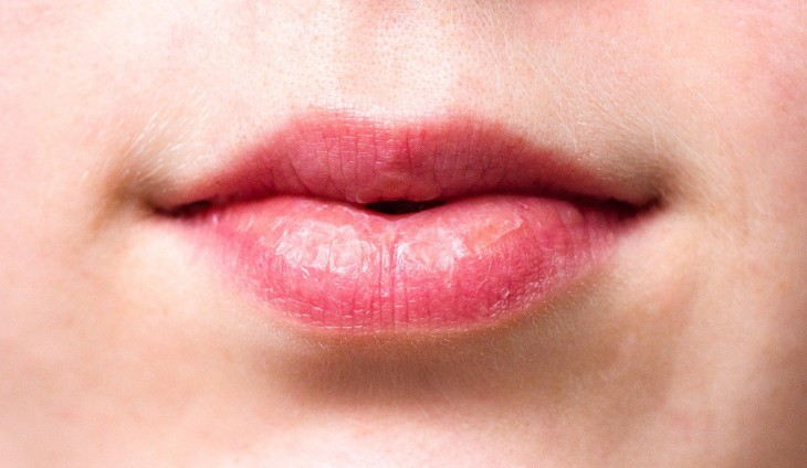 Изменение в голосе может являться признаком рака полости рта