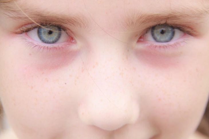 Почему пропало обоняние после простуды: как заставить нос снова чувствовать запахи без аптечных средств лицо