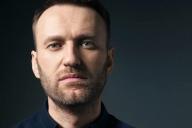 Стало известно состояние Навального перед вылетом в Германию