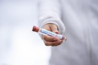 В ВОЗ назвали Швецию примером в борьбе с коронавирусом