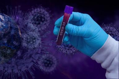 Российский врач назвал характерное для СПИДа последствие коронавируса
