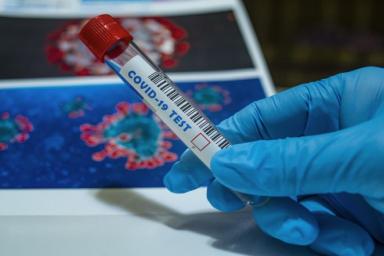 В России создали экспресс-тест на коронавирус по слюне