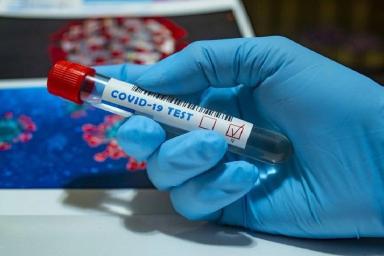 В России ввели ограничения на срок выполнения теста на коронавирус