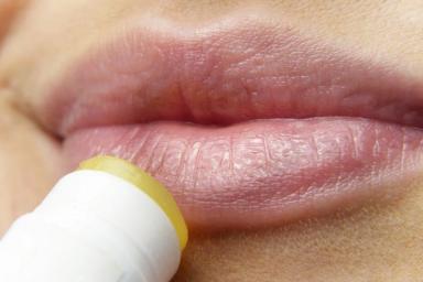 Герпес на губах: как избавиться от простуды на губах