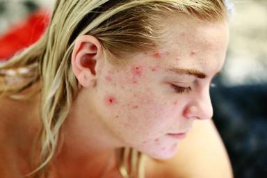 7 популярных мифов об уходе за кожей, которые приносят больше вреда, чем пользы