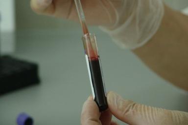 Ученые нашли эффективный метод поиска раковых клеток в крови