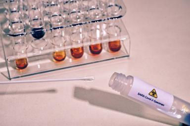 Ученые разработали быстрый и точный тест на коронавирус