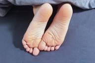 Китайские ученые раскрыли загадку уязвимости ахиллова сухожилия