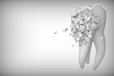 Ученые соорудили механическую модель сверления зуба
