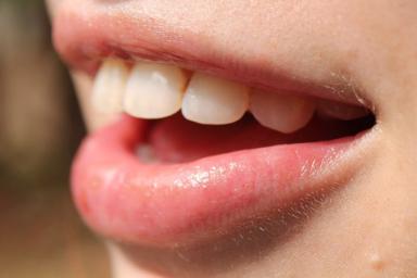 10 мифов об уходе за зубами