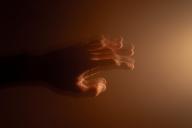 Болезнь Паркинсона 