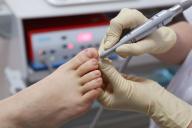 Не игнорируйте это специфическое изменение ногтя: оно может свидетельствовать об опасном недуге