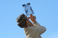 Рентгеновский снимок